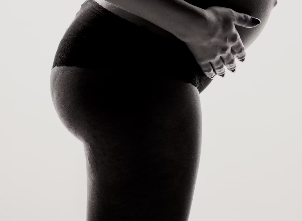 Hormones & Butt Breakouts: The Pregnancy Connection